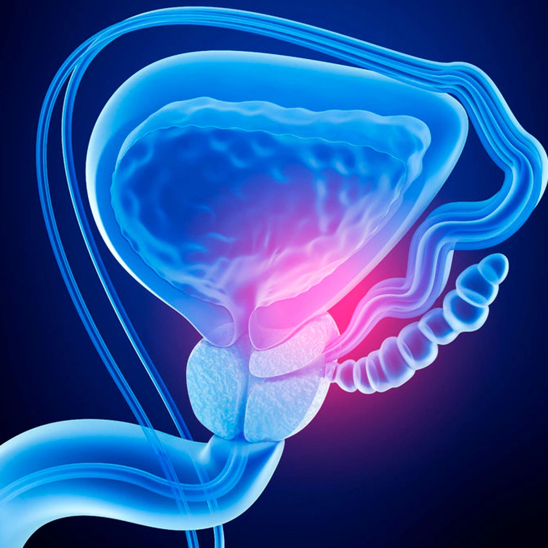 🌿UROCIANINA – Apoyo natural para la salud de la próstata - HOUSKYCHILE