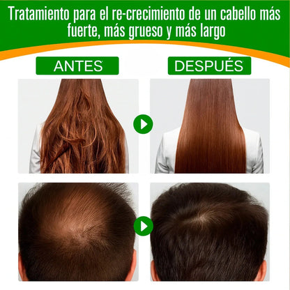Aceite de Batana 100 % Puro – Crecimiento, Nutrición y Brillo Natural para tu Cabello ✨ - HOUSKYCHILE