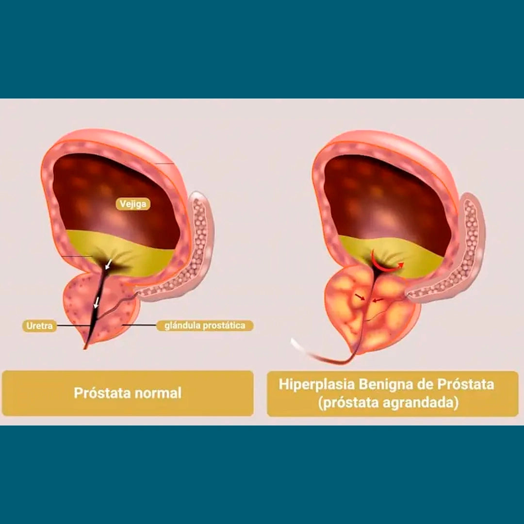 🌿UROCIANINA – Apoyo natural para la salud de la próstata - HOUSKYCHILE